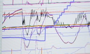 F1 telemetry: The data race