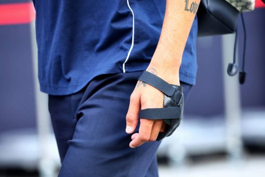 The injured hand of Daniel Ricciardo (AUS) AlphaTauri.
14.09.2023. Formula 1 World Championship, Rd 16, Singapore Grand Prix, Marina Bay Street Circuit, Singapore, Preparation Day.
- www.xpbimages.com, EMail: requests@xpbimages.com © Copyright: Batchelor / XPB Images